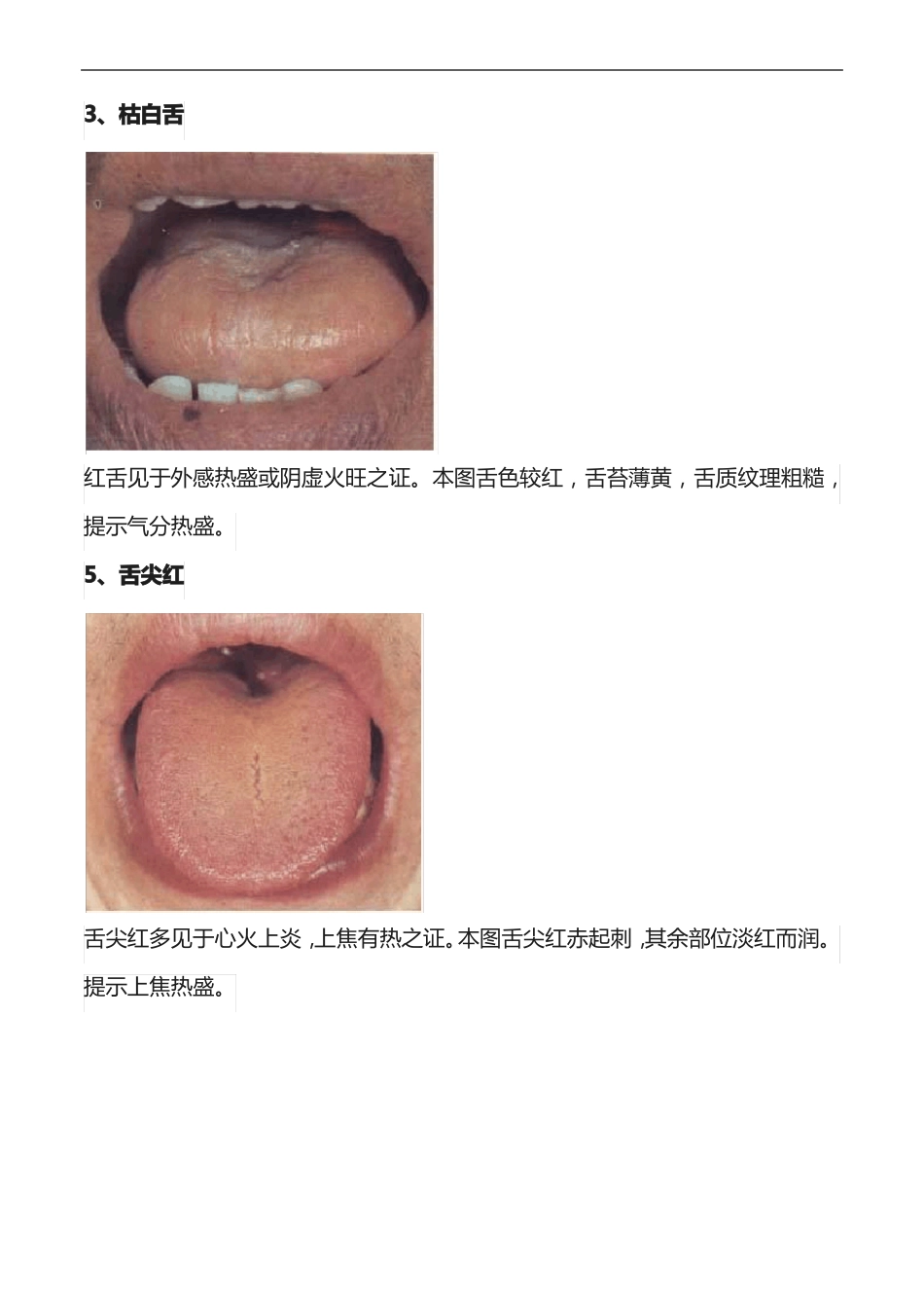 61张高清舌诊图谱珍藏版_第3页