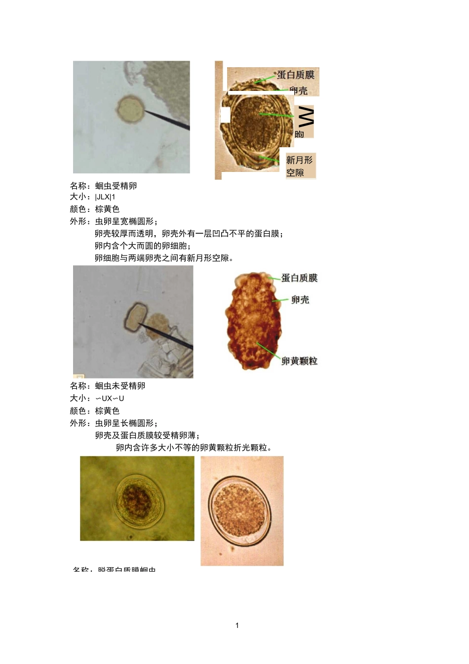 寄生虫虫卵镜下图片汇总_第1页