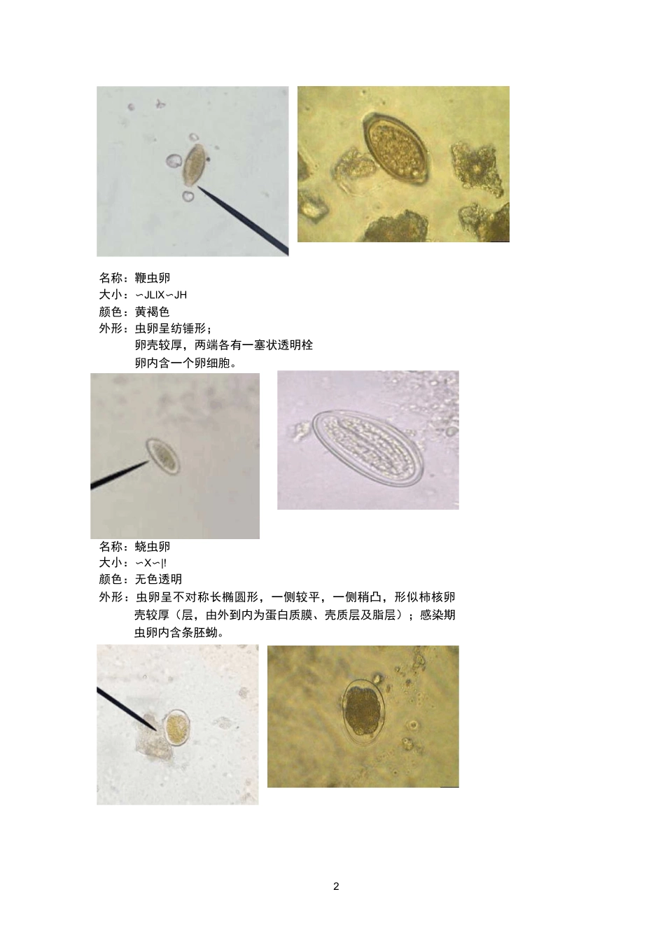 寄生虫虫卵镜下图片汇总_第2页