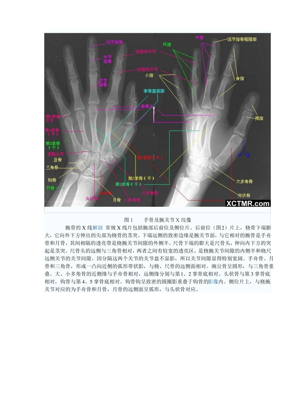 下肢骨X线解剖讲解非常经典_第3页