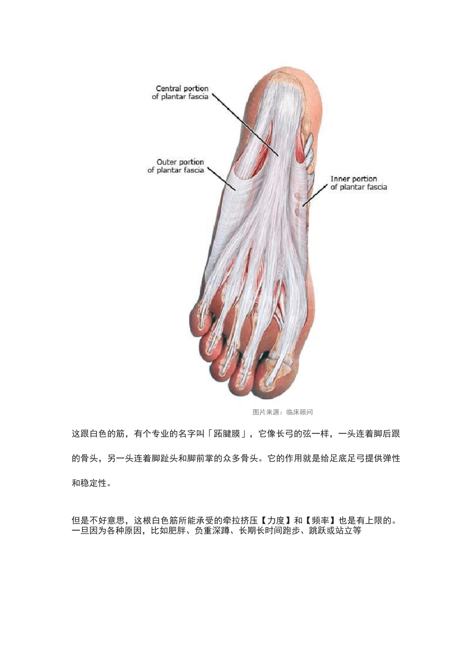 「足底筋膜炎」？所有你想知道的,应该知道的,都在这里了_第3页