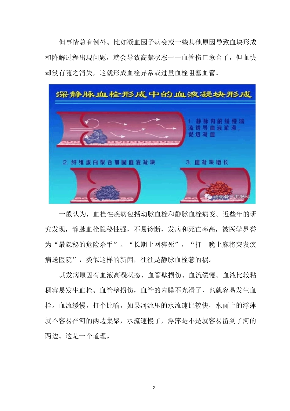 深静脉血栓的预防措施_第2页