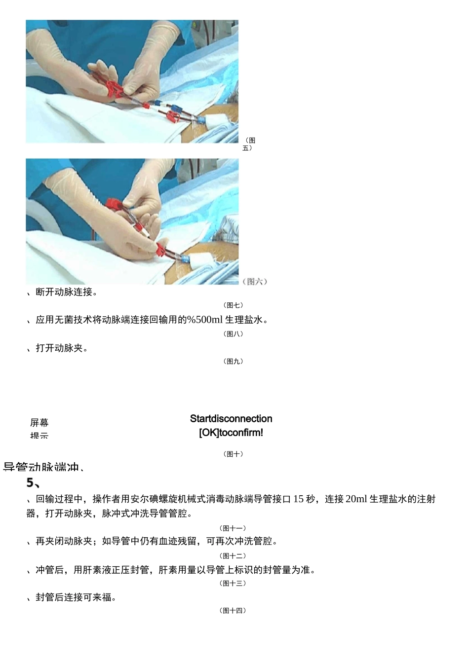 费森血滤机停血滤的流程_第3页