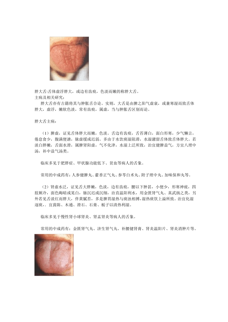 中医舌诊辨证_第3页