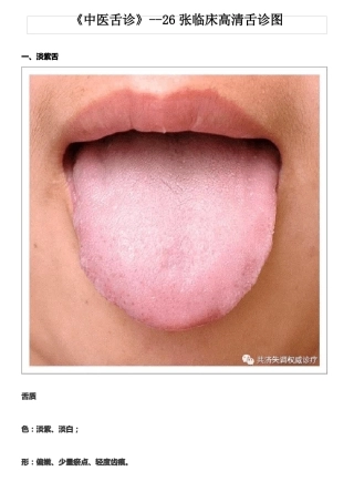 中医舌诊-真人彩图
