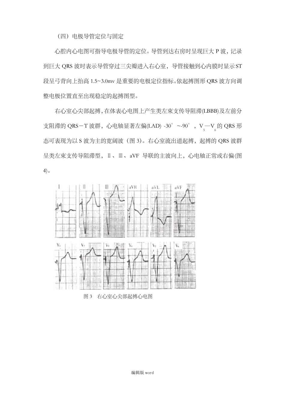 临时心脏起搏器的安置术_第2页