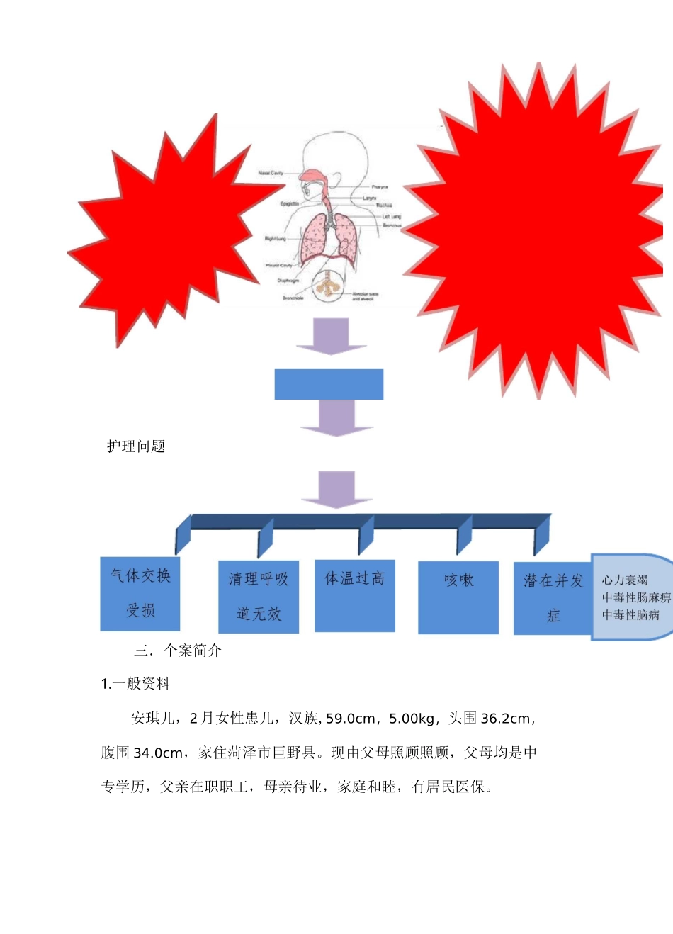一例重症肺炎患儿护理体会_第2页