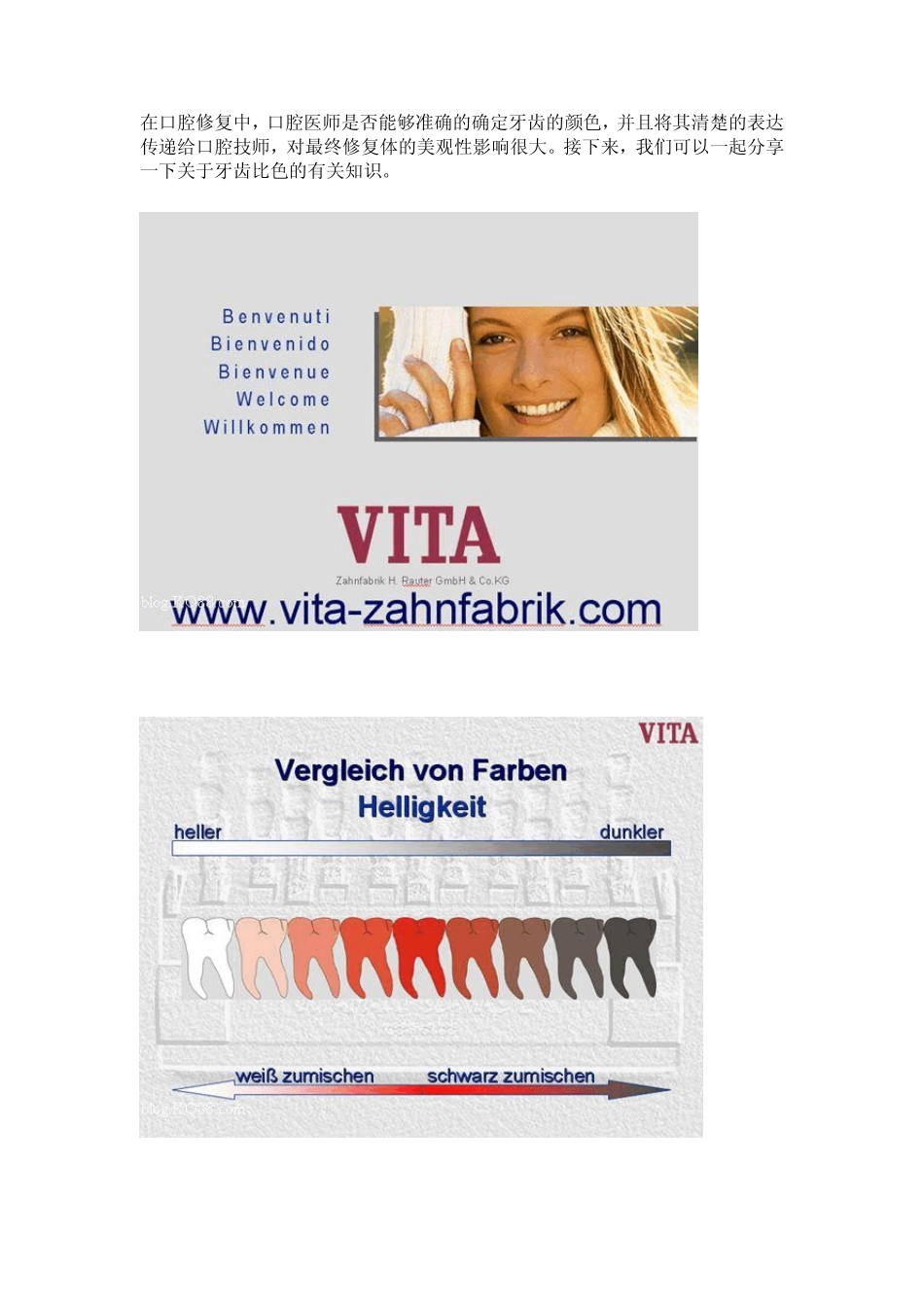 牙科专家详细讲解牙科比色_第1页