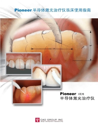 牙科手术的最爱半导体激光治疗仪使用方法及案例