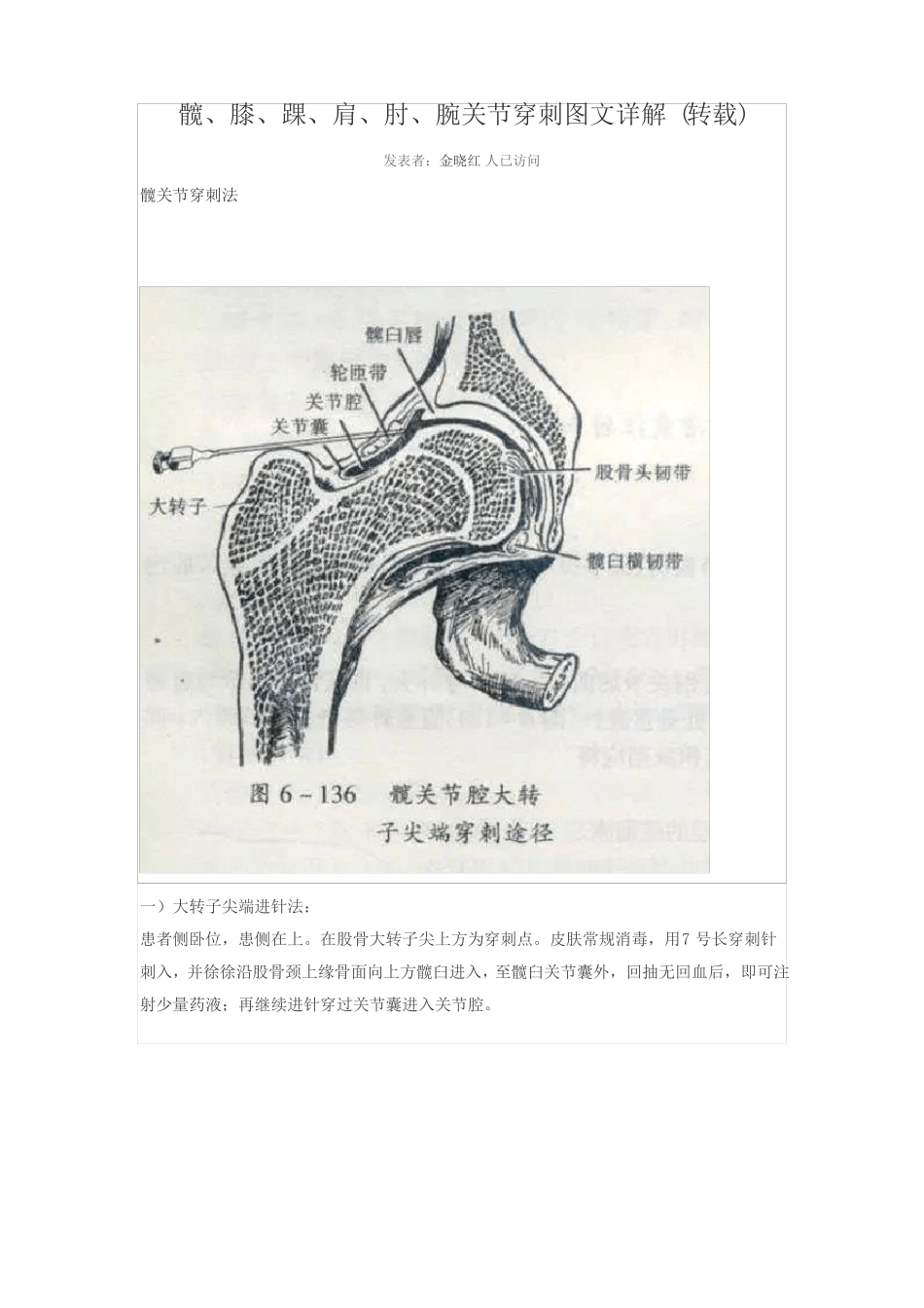关节腔穿刺术_第1页