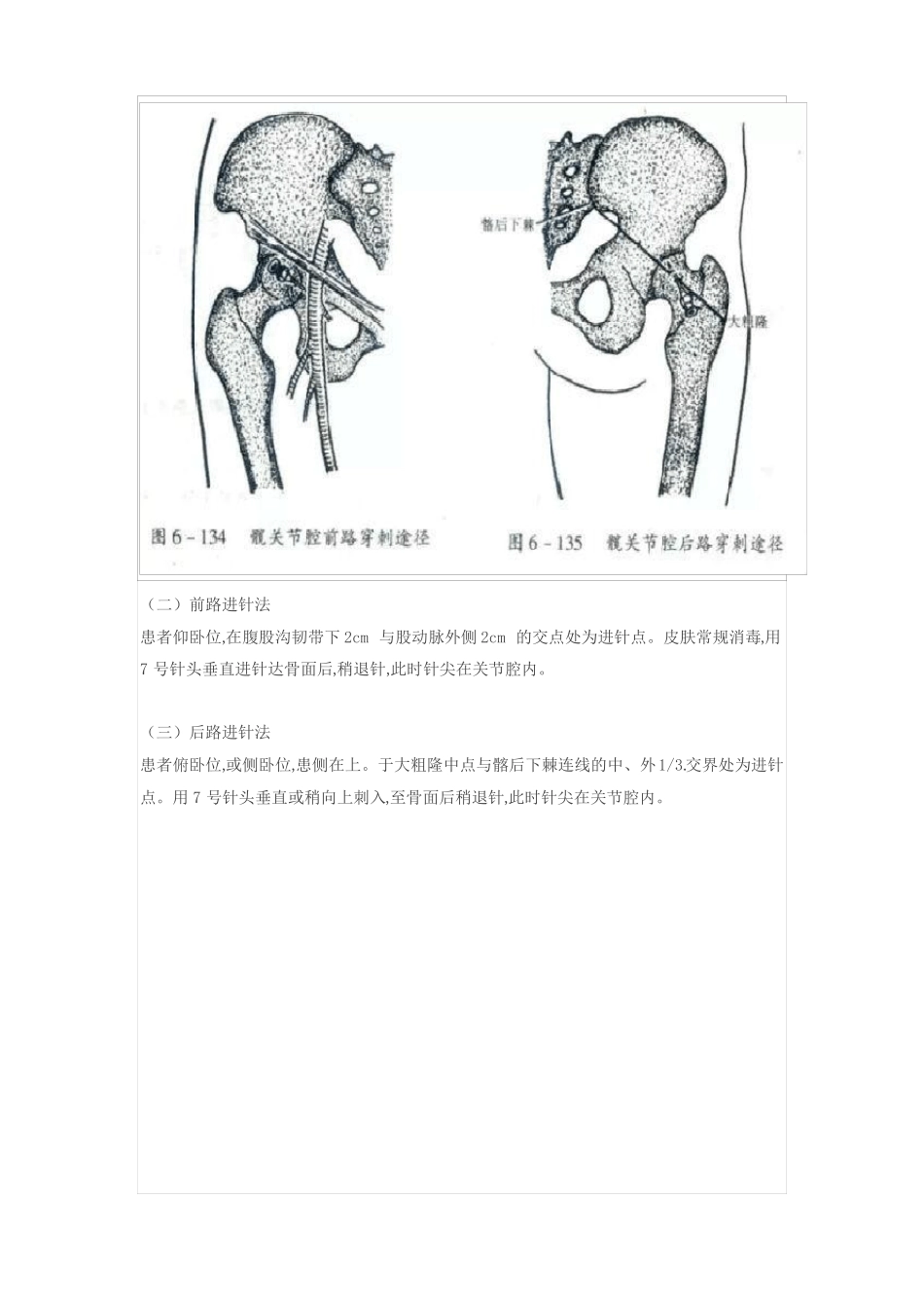 关节腔穿刺术_第2页