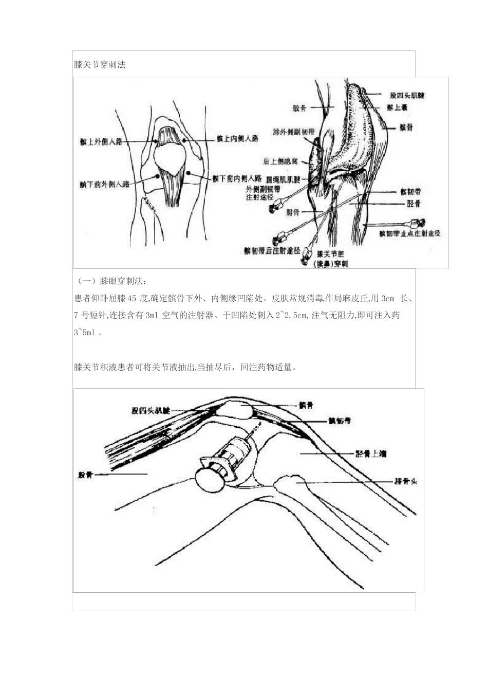 关节腔穿刺术_第3页
