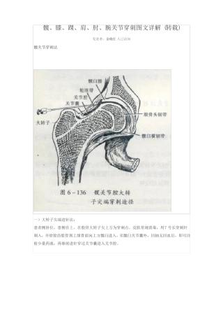 关节腔穿刺术