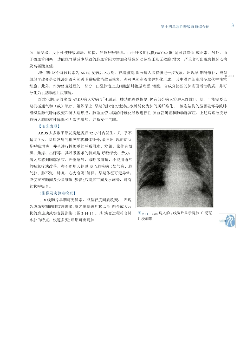 内科学人卫第9版教材--高清彩色_急性呼吸窘迫综合征_第3页