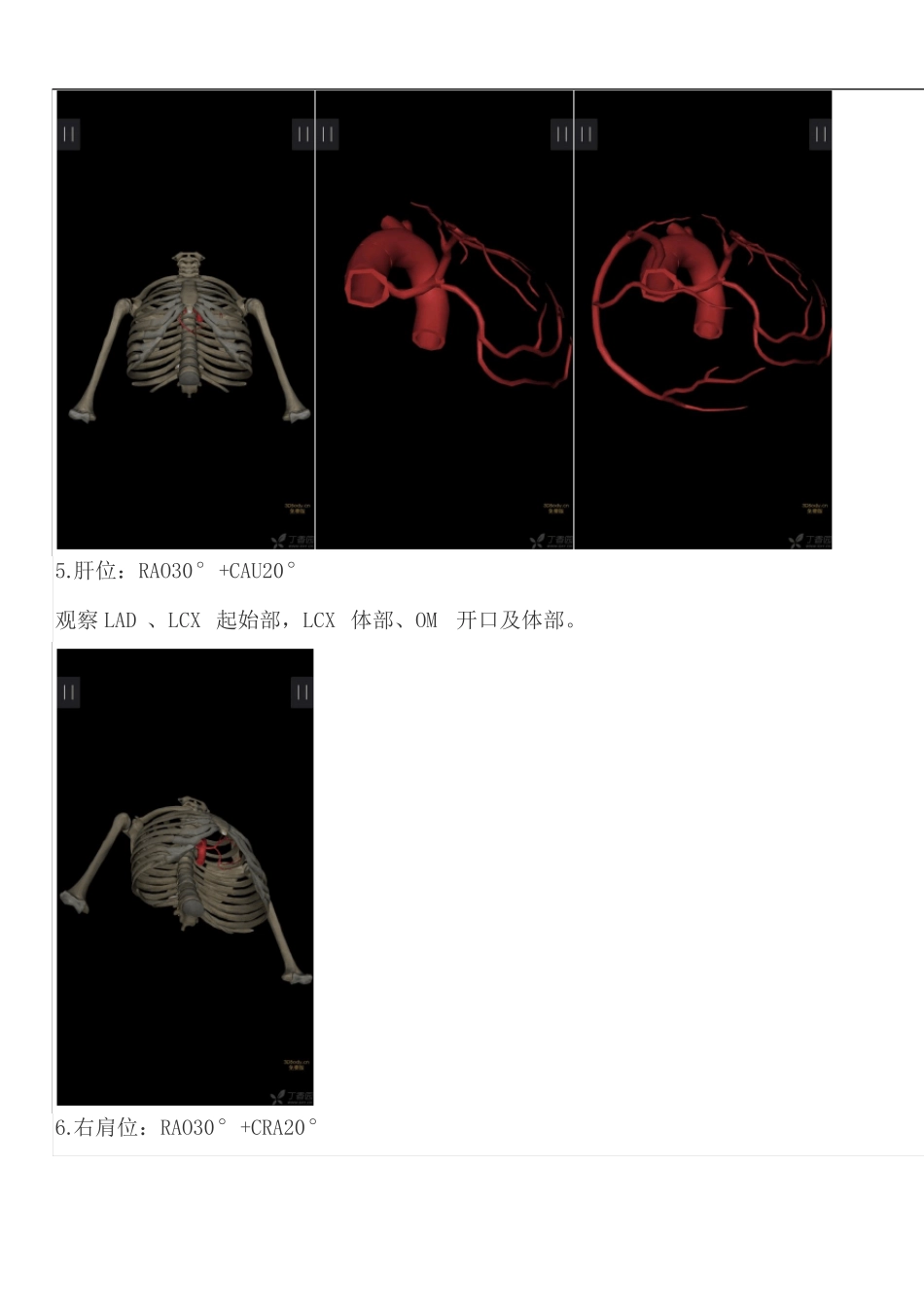 冠脉造影常用体位_第3页