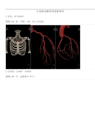 冠脉造影常用体位