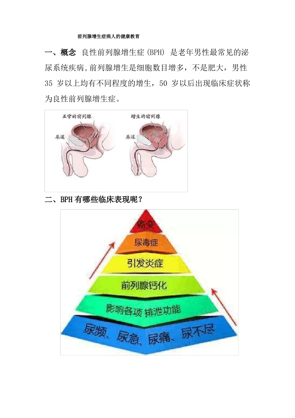 前列腺增生症病人的健康教育图文_第1页