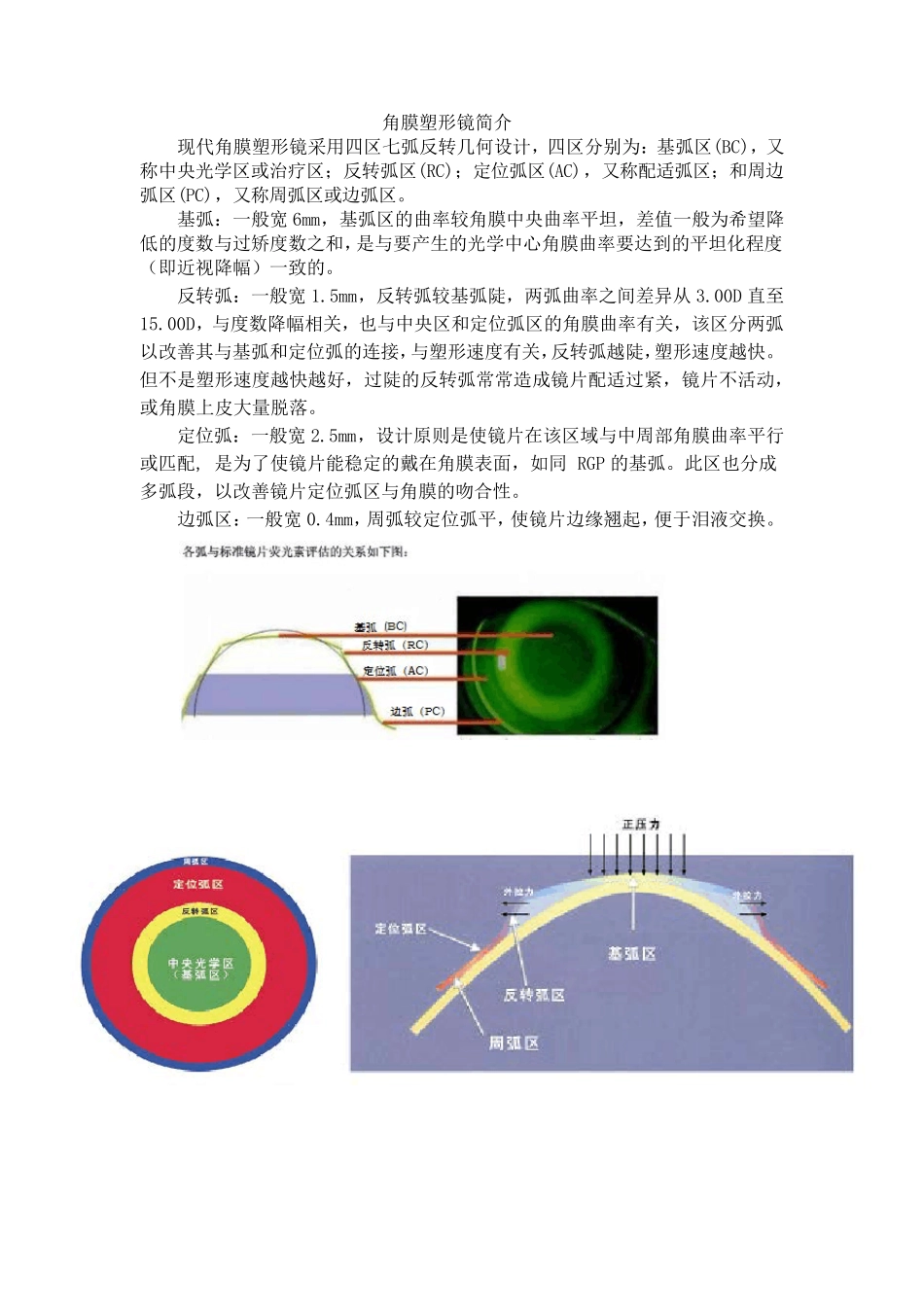 现代角膜塑形镜_第1页