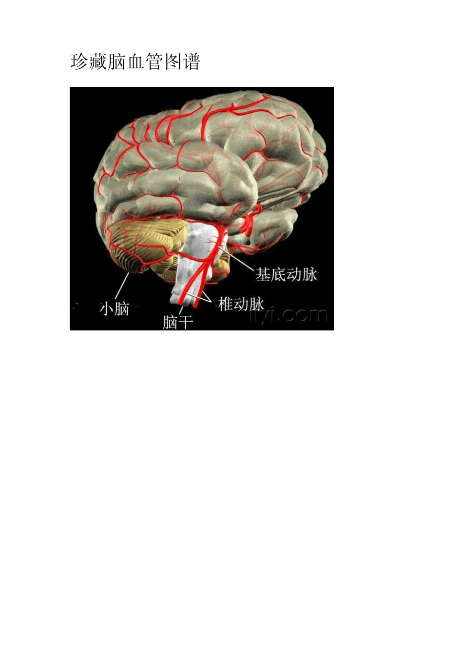 珍藏脑血管图谱_第1页
