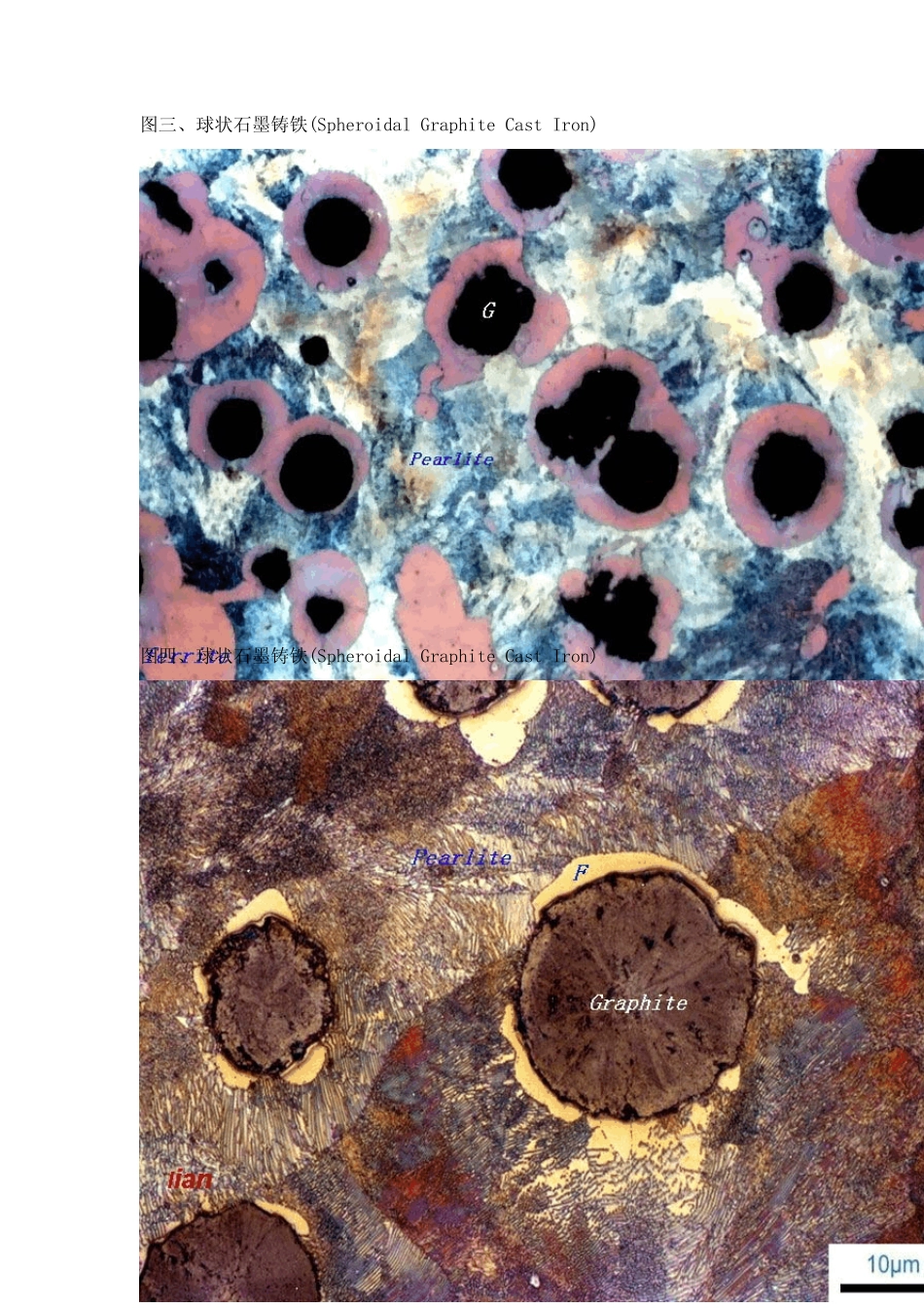 球铁金相组织_第2页
