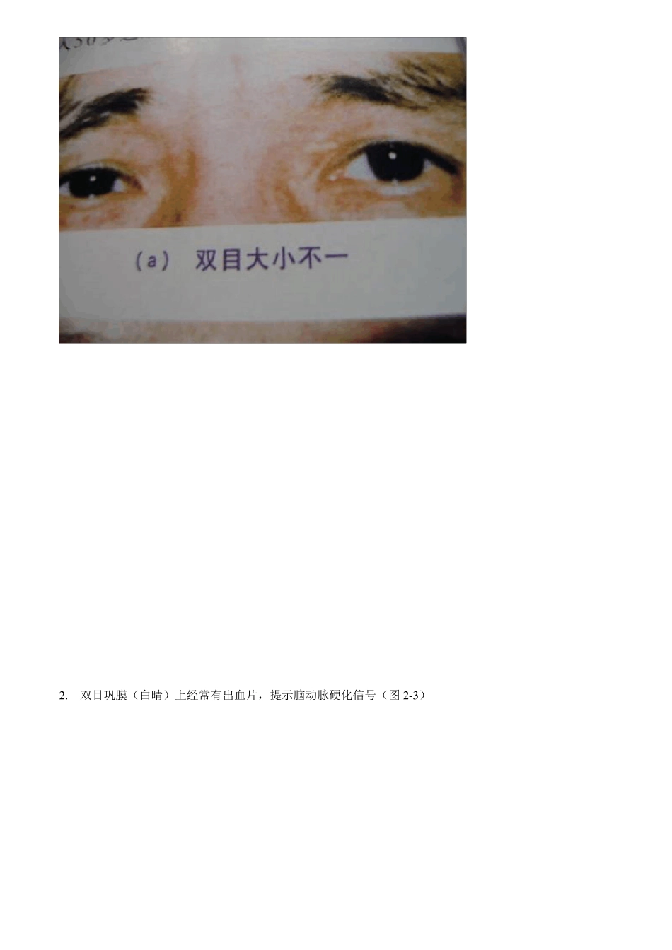 瑶医目诊图望面诊病图解目诊_第2页