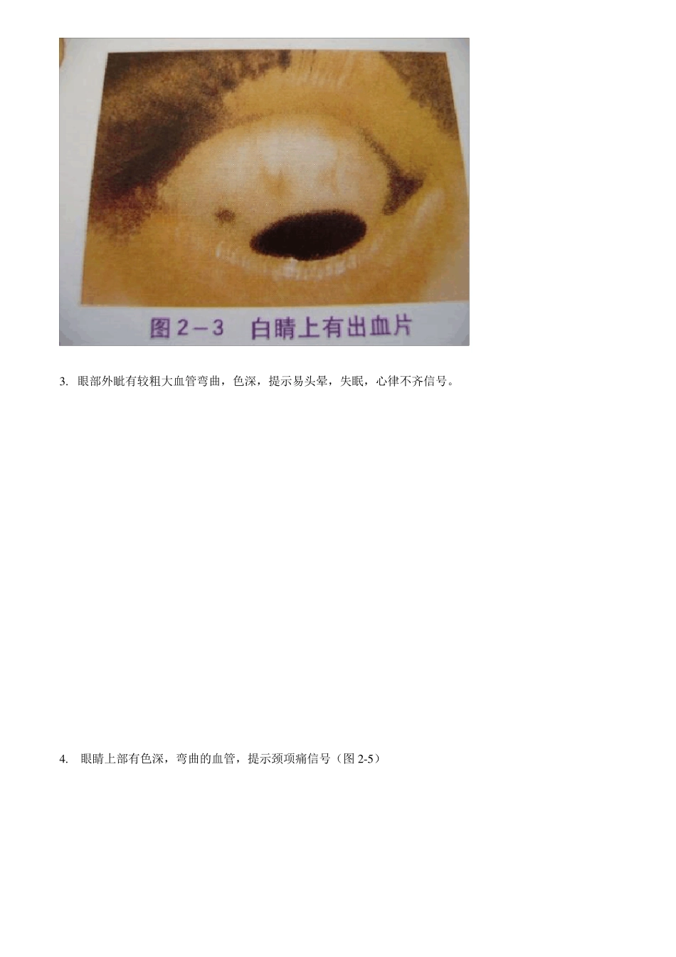 瑶医目诊图望面诊病图解目诊_第3页