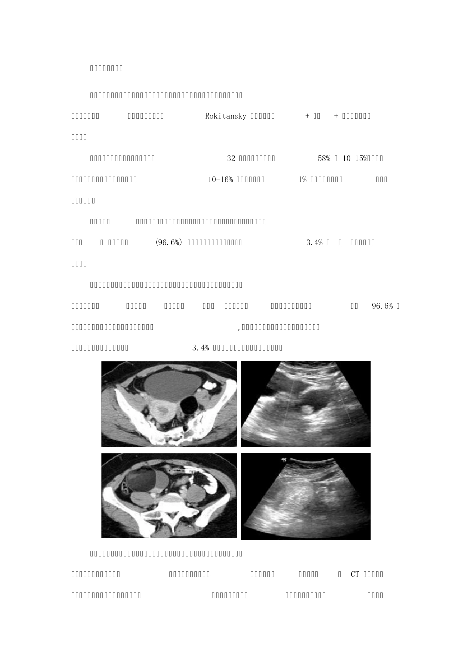 生殖细胞肿瘤CT诊断_第3页