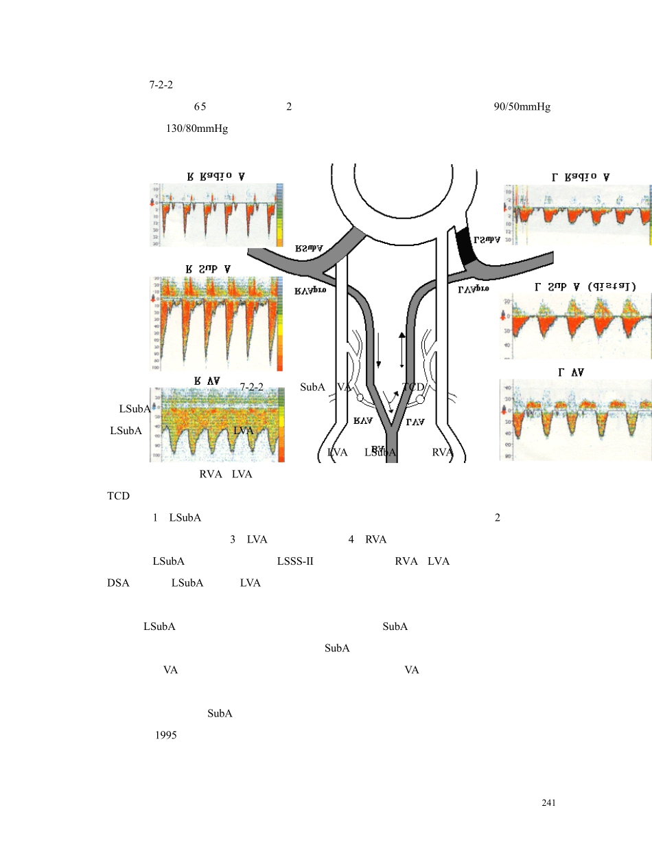第七章第二节锁骨下动脉盗血综合征的实例分析和TCD报告书写_第2页
