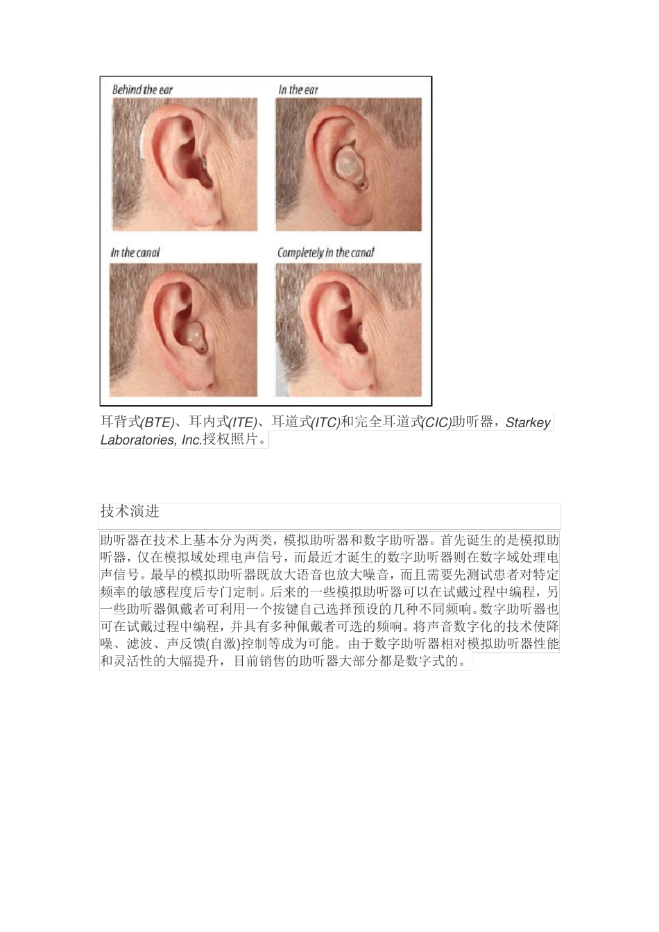 助听器介绍及其设计要点讲解_第2页