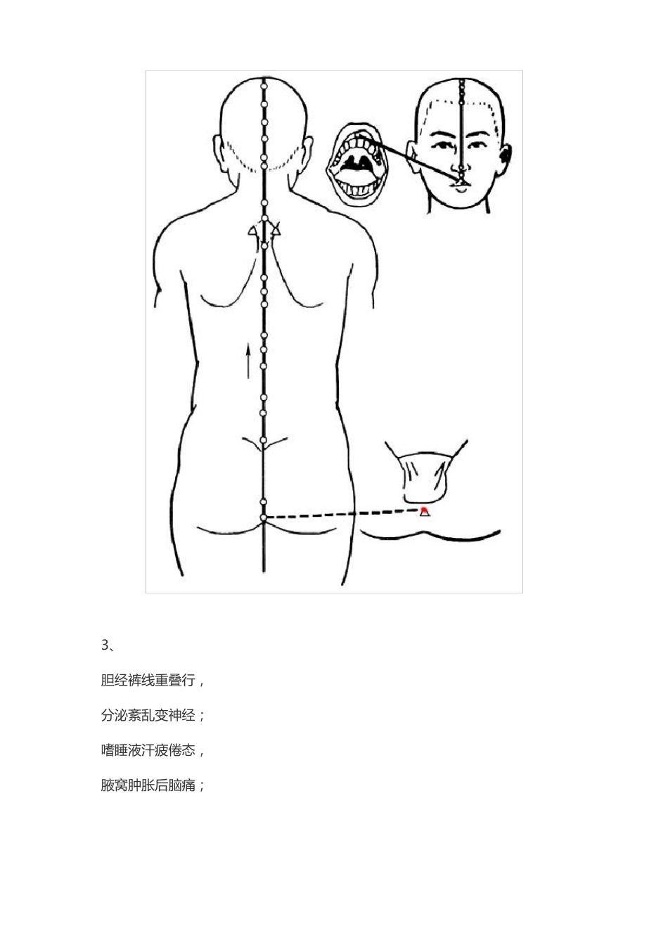 十四经络歌谣_第3页