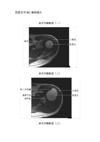 四肢关节MRI解剖图片
