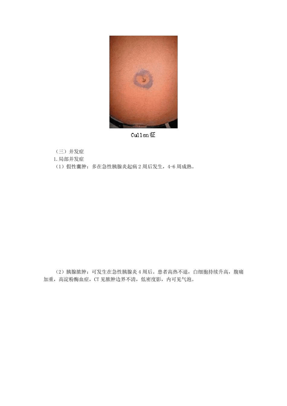 第三章病例分析——急性胰腺炎_第3页