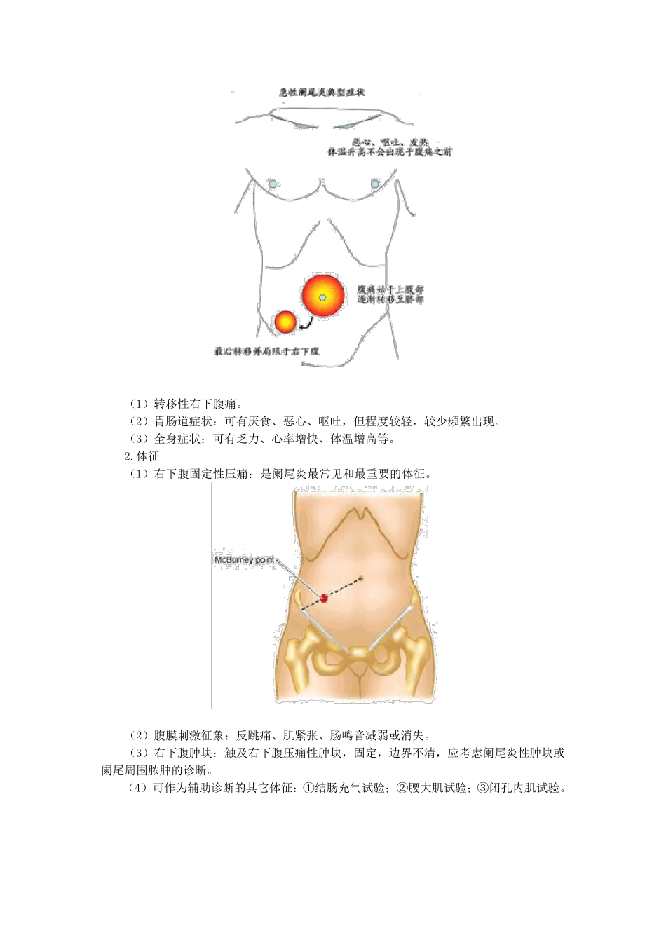 第三章病例分析——急腹症_第2页
