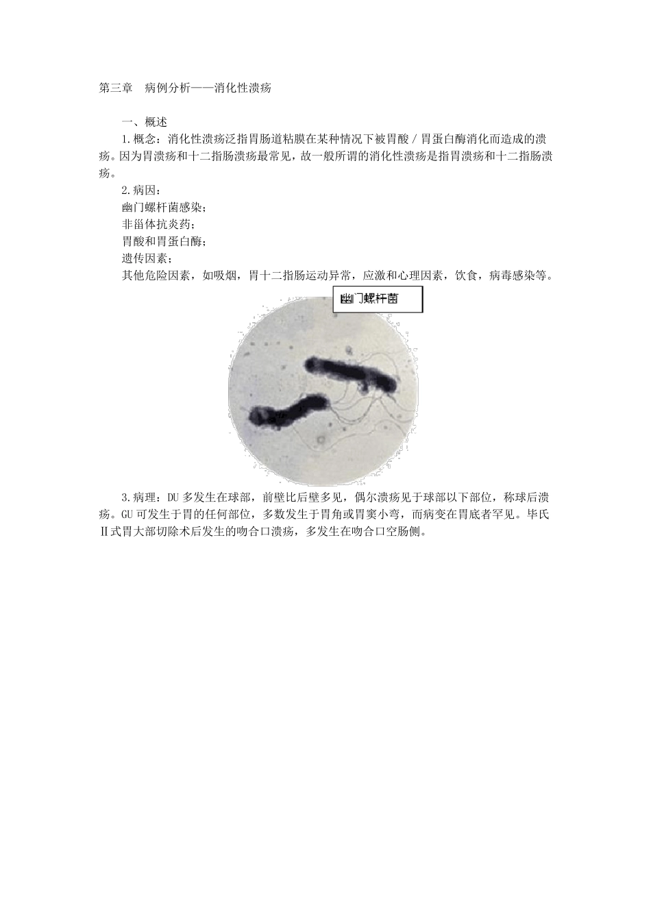 第三章病例分析——消化性溃疡_第1页