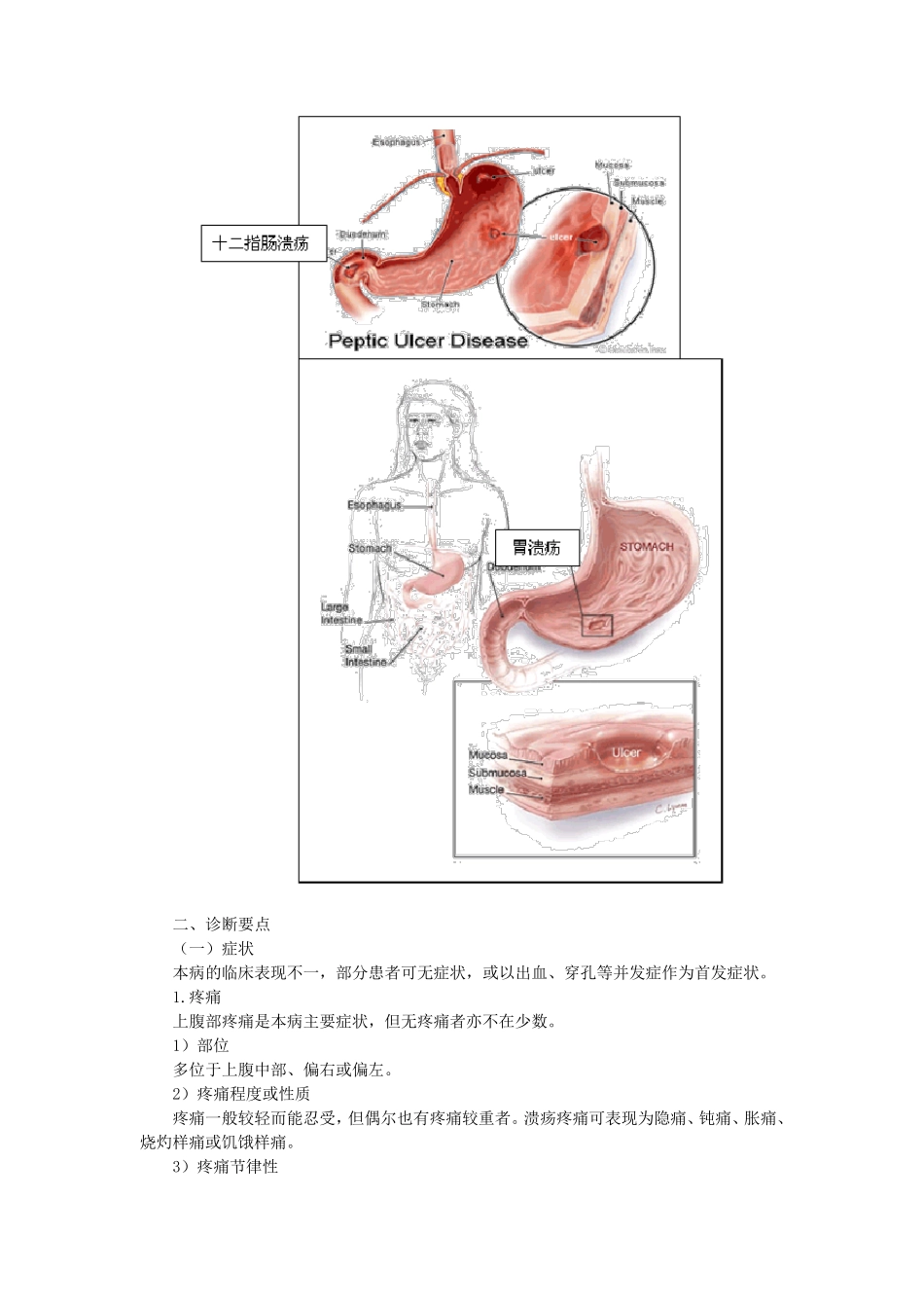 第三章病例分析——消化性溃疡_第3页