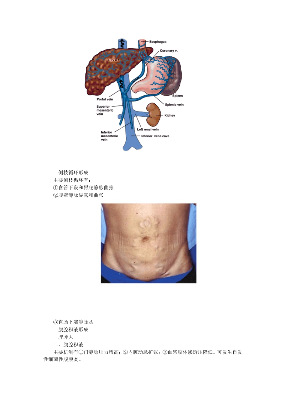 第三章病例分析——肝硬化_第2页