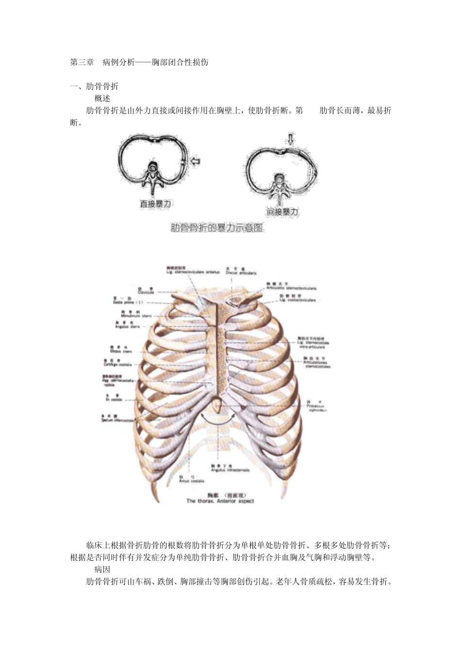 第三章病例分析——胸部闭合性损伤_第1页