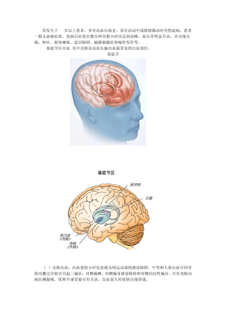 第三章病例分析——脑血管疾病_第2页