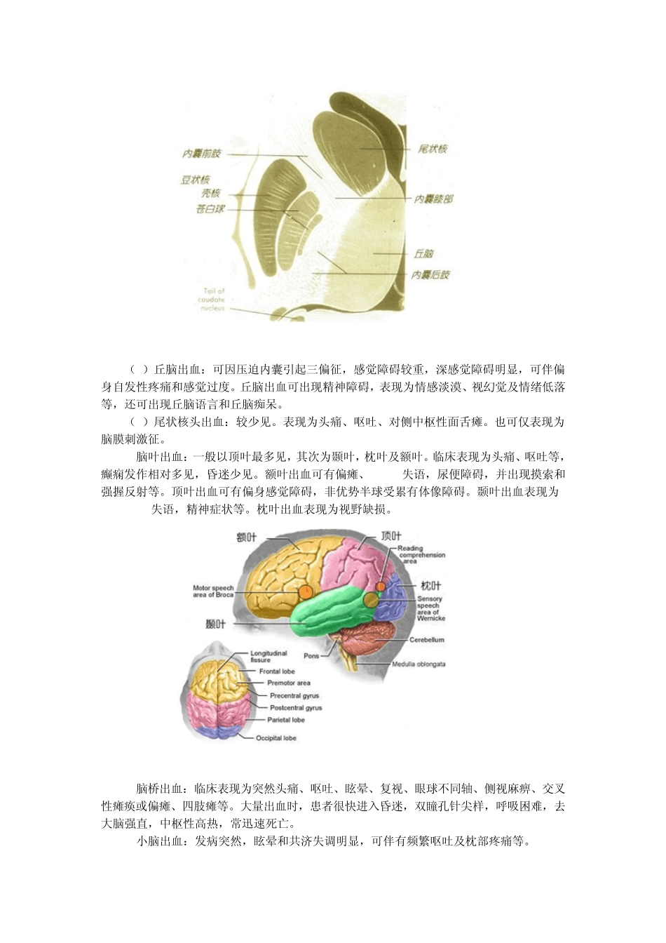 第三章病例分析——脑血管疾病_第3页