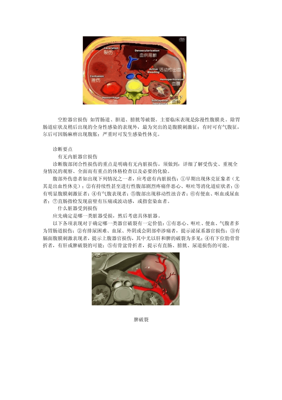 第三章病例分析——腹部闭合性损伤_第2页