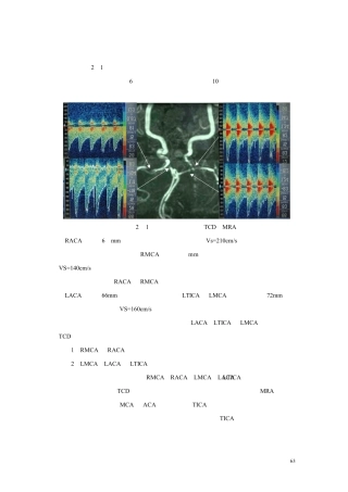 第五章第二节颅内血管狭窄和闭塞实例分析1