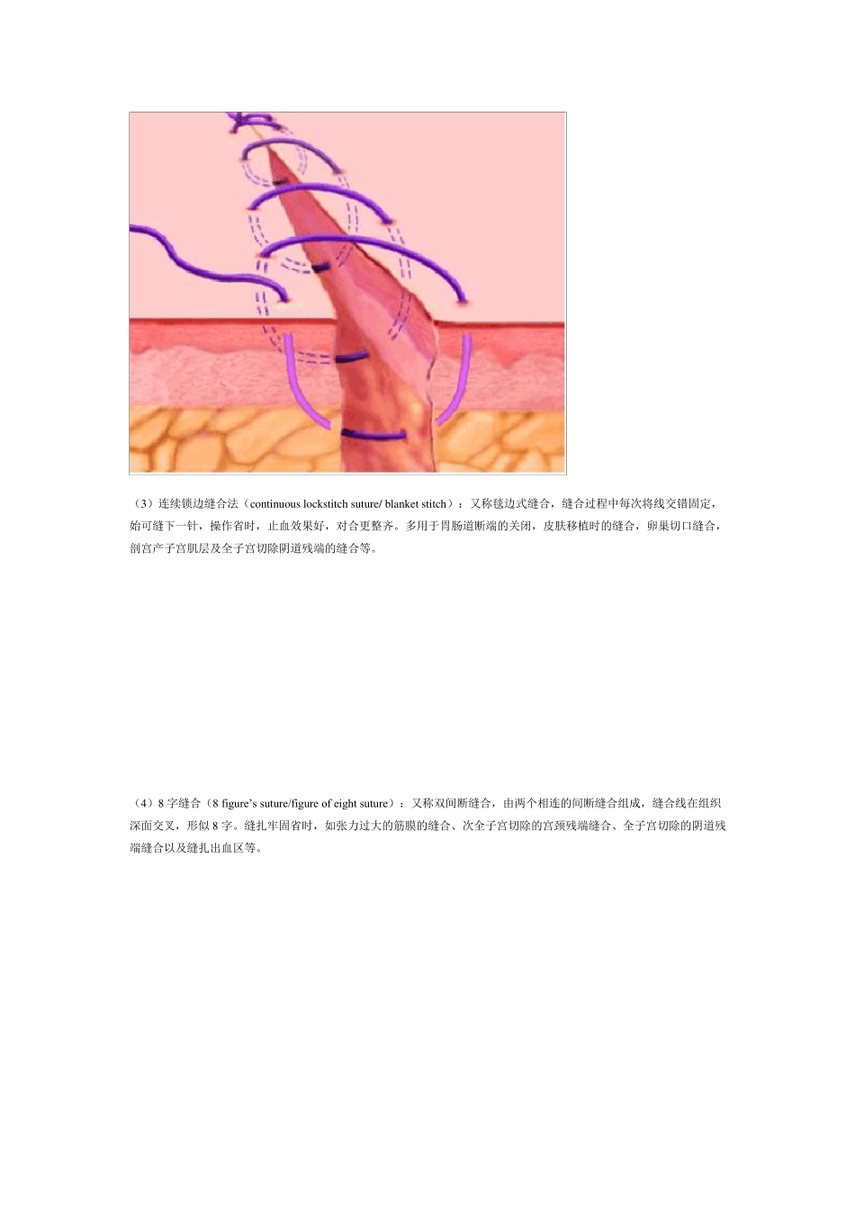 缝合手法图文讲解_第3页