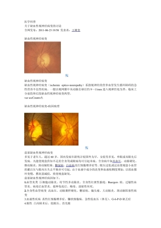 缺血性视神经病变