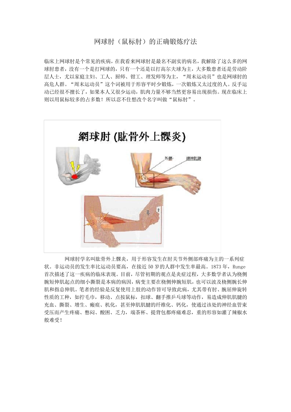 网球肘(鼠标肘)的正确锻炼疗法_第1页