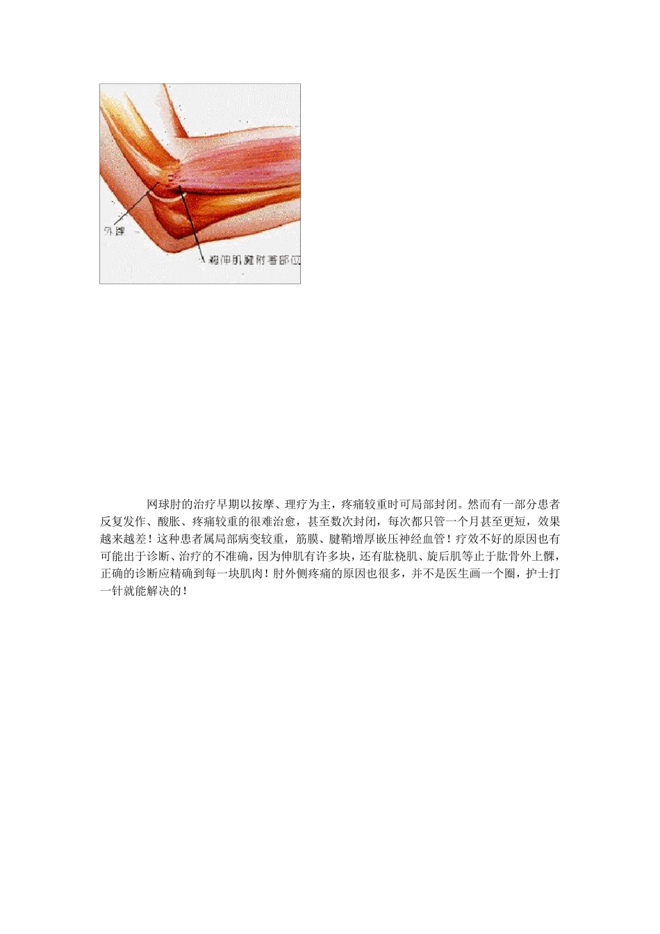网球肘(鼠标肘)的正确锻炼疗法_第2页