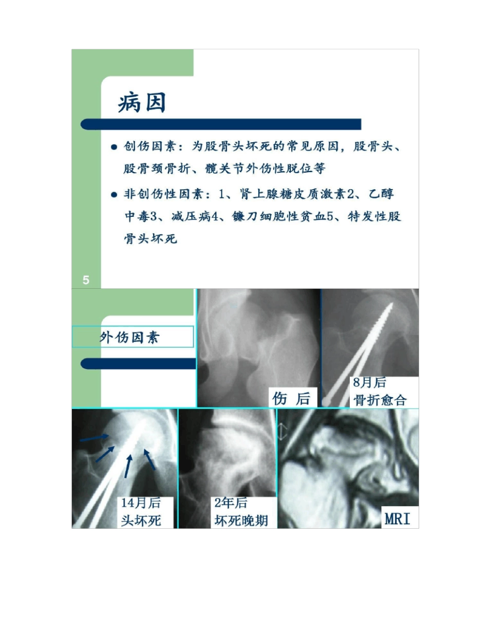 外科学第八版股骨头坏死课件精_第3页