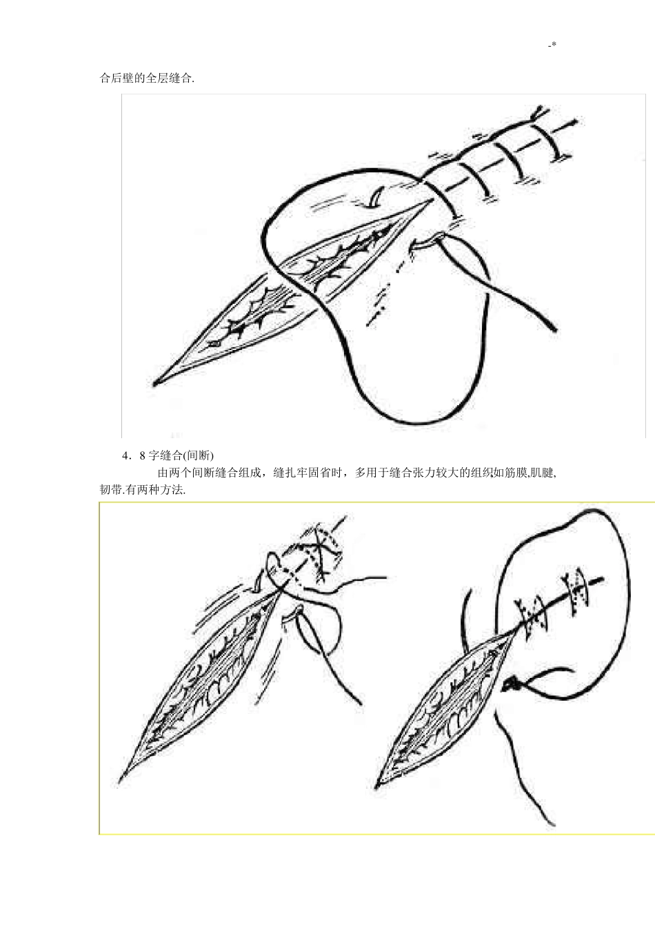外科缝合的步骤和方法及剪线的基本方法_第3页