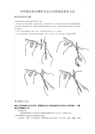 外科缝合的步骤和方法及剪线的基本方法