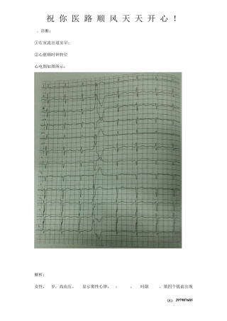 20个心电图解析+记忆技巧