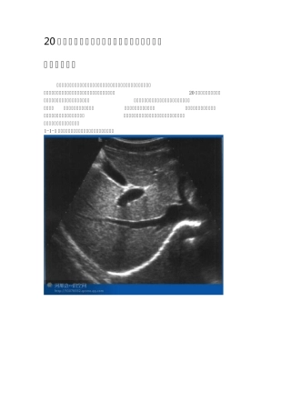 20个肝脏超声切面你常用哪几种切面来应对肝脏方面的检查